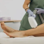 depilacao a laser realmente elimina os pelos